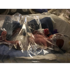 Premature baby born at 31 5/7 wks